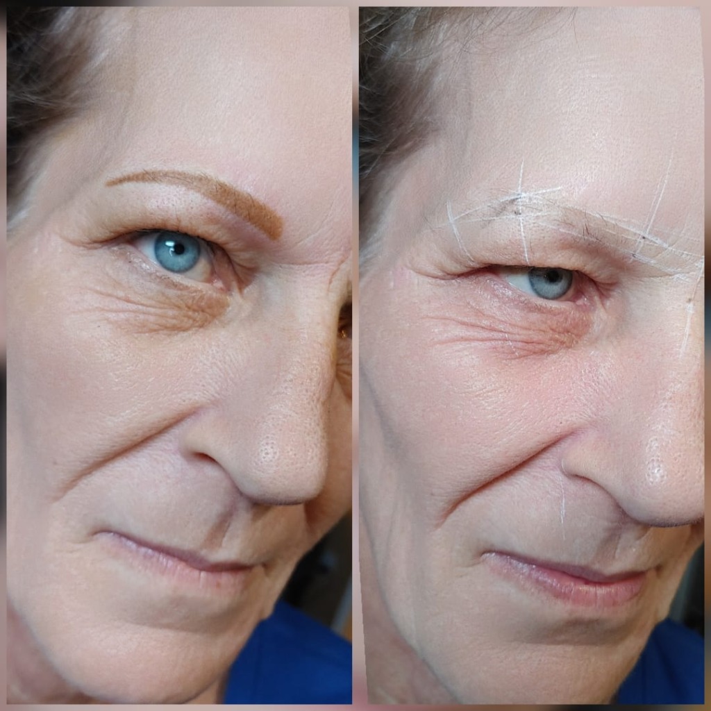Brow Mapping