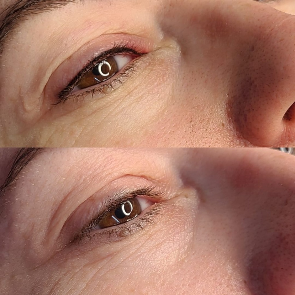 Eyeliner Enhancement