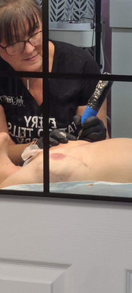 Areola Restoration Session